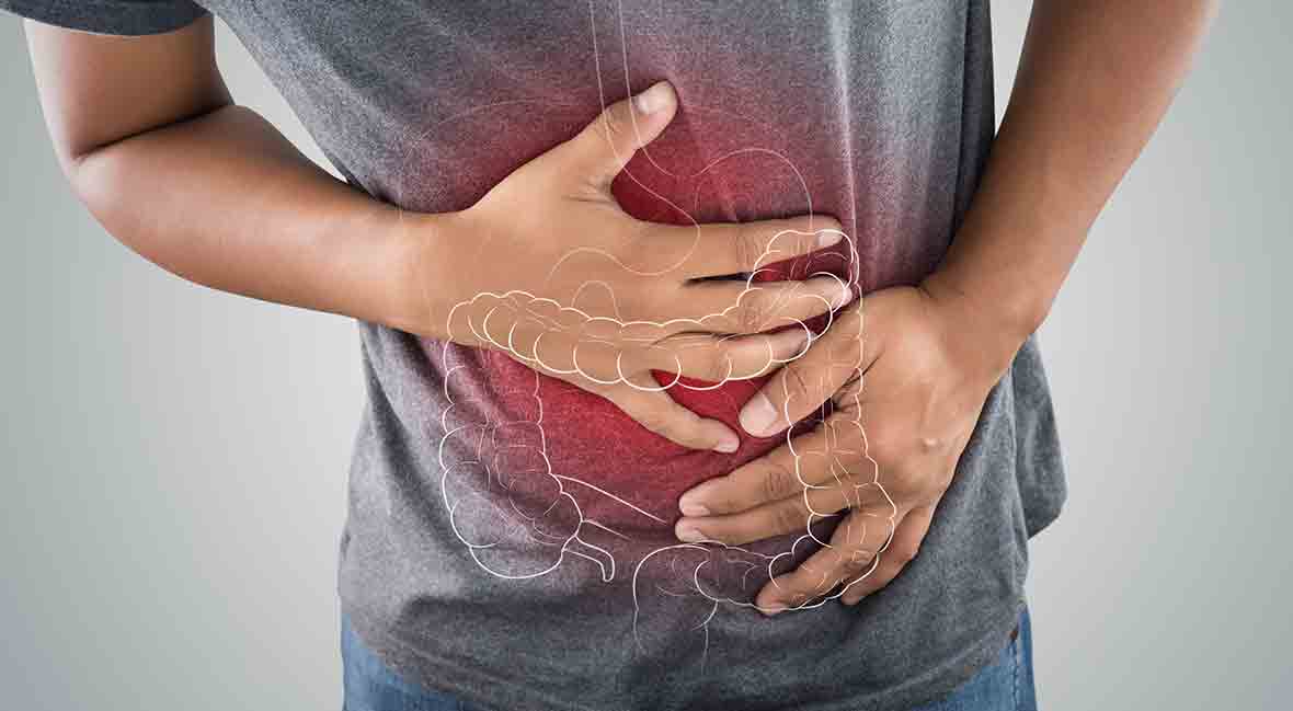 LICDH-Blog-Ulcerative-Colitis-101